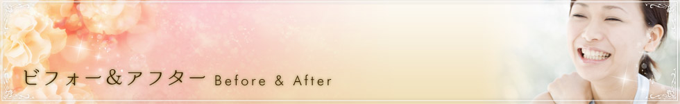 �r�t�H�[���A�t�^�[�@Before & After